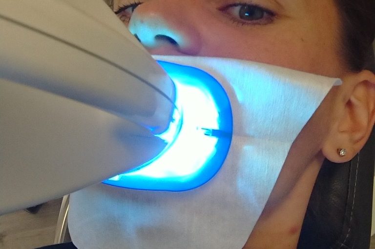 Zahnarztbehandlung mit einem blauen Lichtgerät und einer Patientin mit Mundschutz.