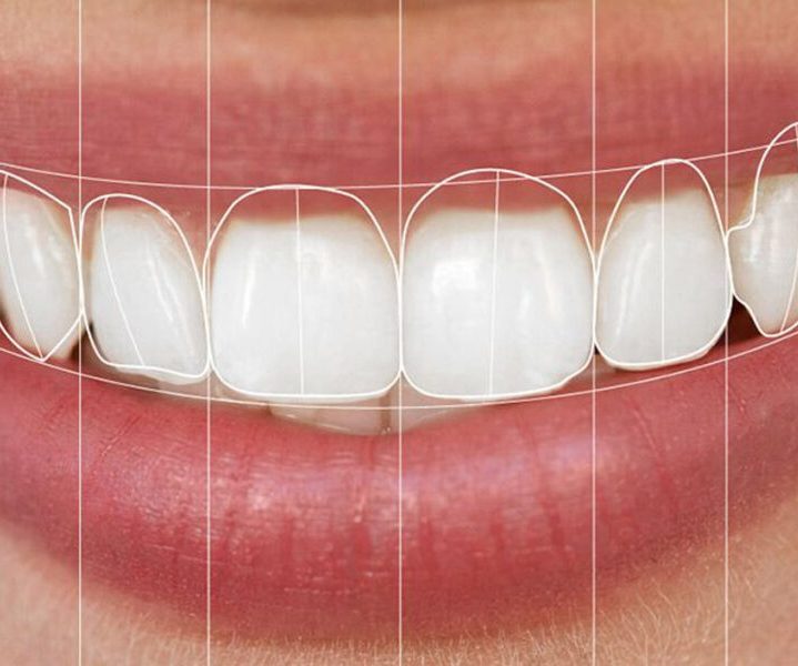 Lächelnde Person mit weißen Zähnen vor einem neutralen Hintergrund.